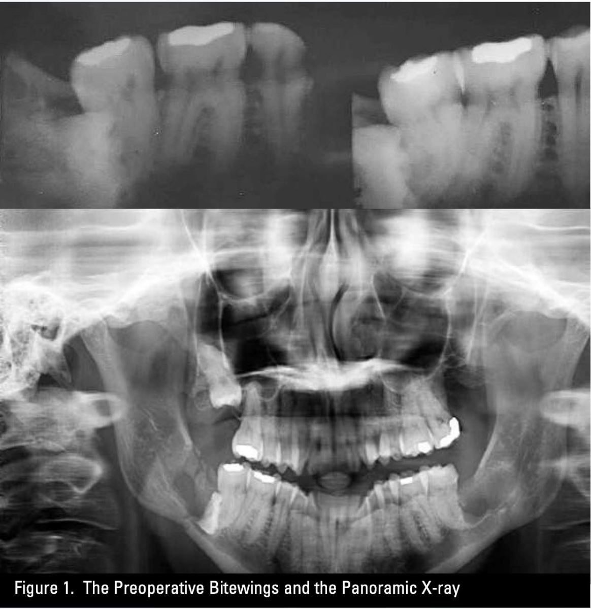 Dental Imaging and the Standard of Care